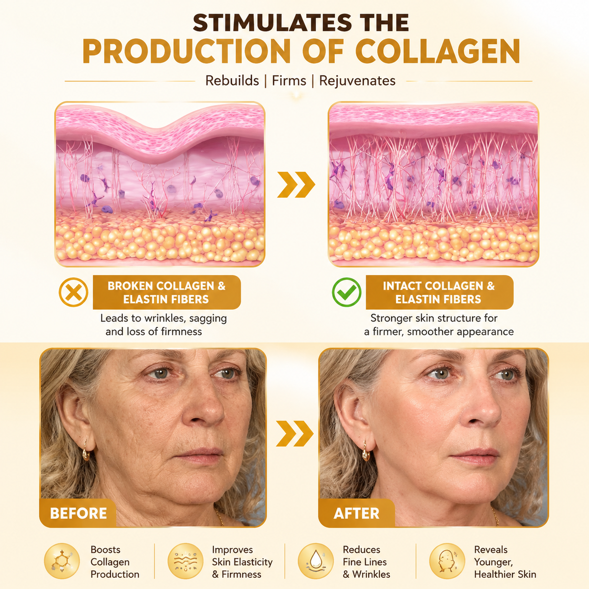 Vitigo Corrector Cream