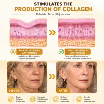 Vitigo Corrector Cream