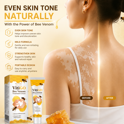 Vitigo Corrector Cream