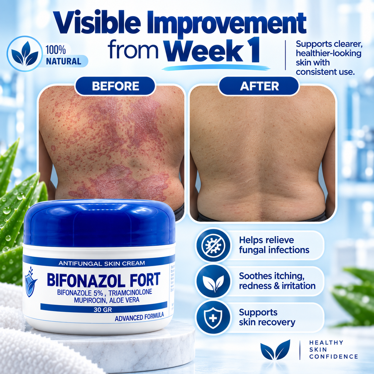 Antifungal Skin Cream