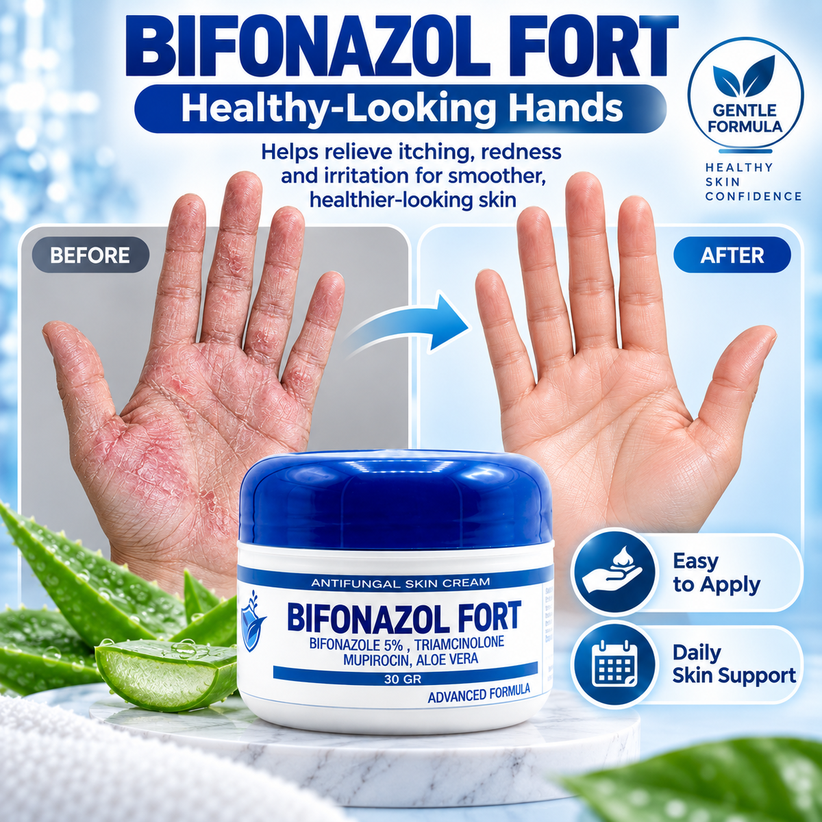 Antifungal Skin Cream