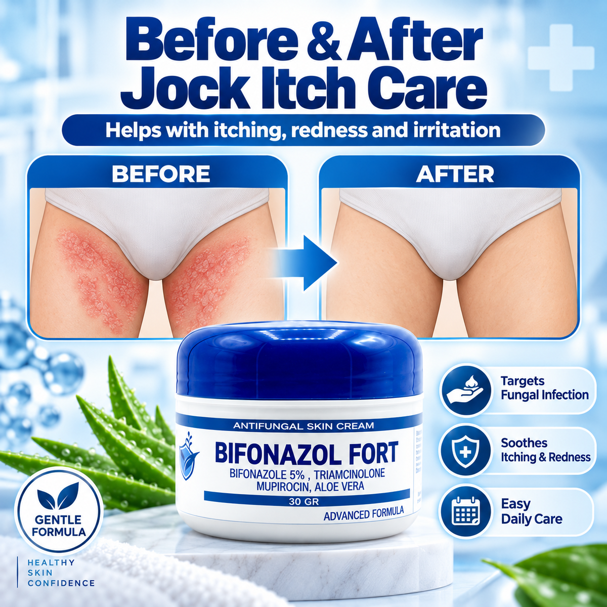 Antifungal Skin Cream