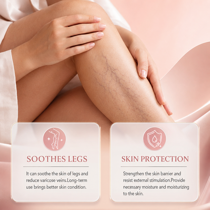 Varicose Veins Relief Cream