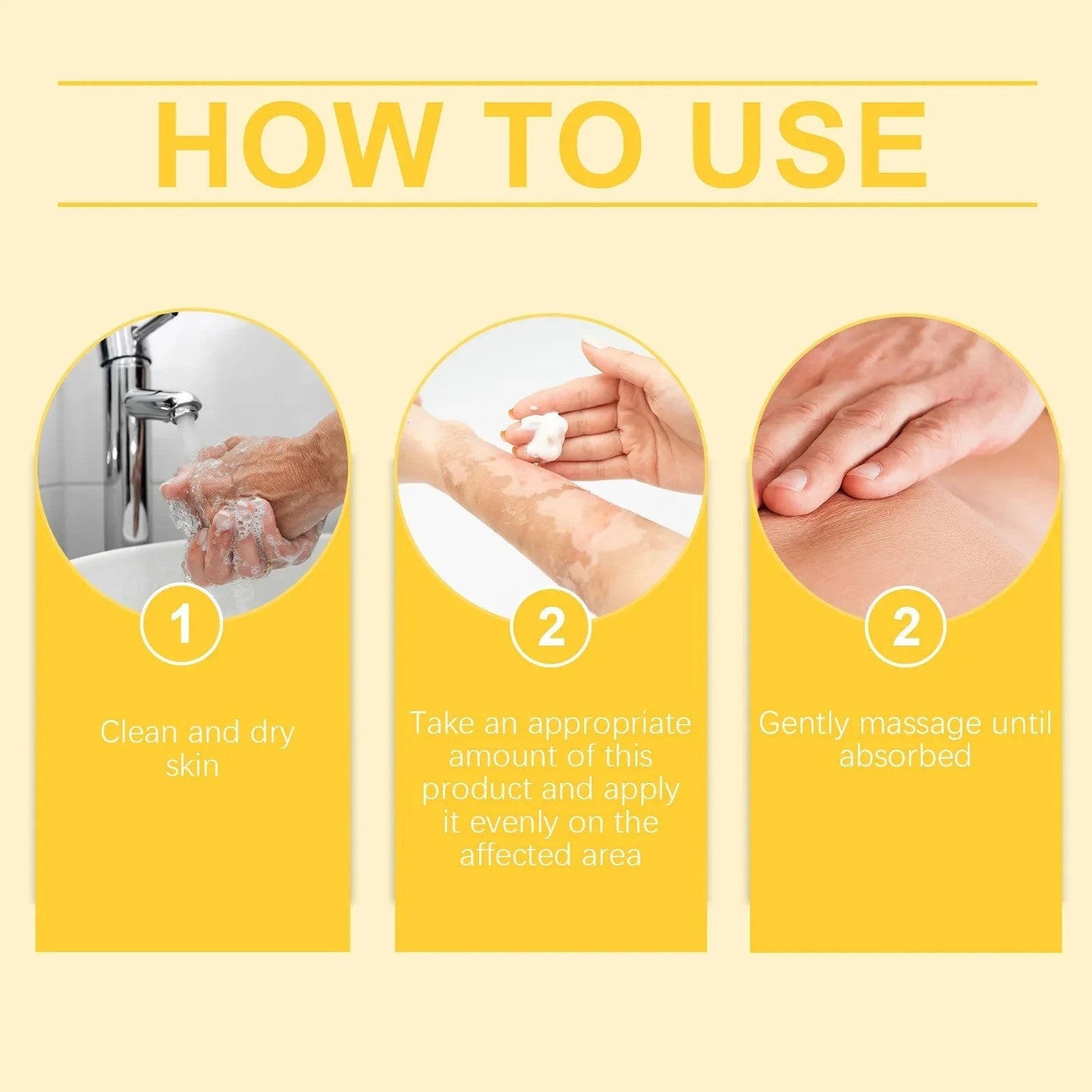 Vitigo Corrector Cream