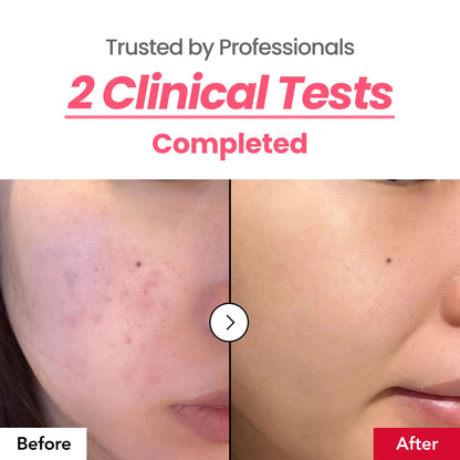 Dark Spot Correcting Pink Glow Cream
